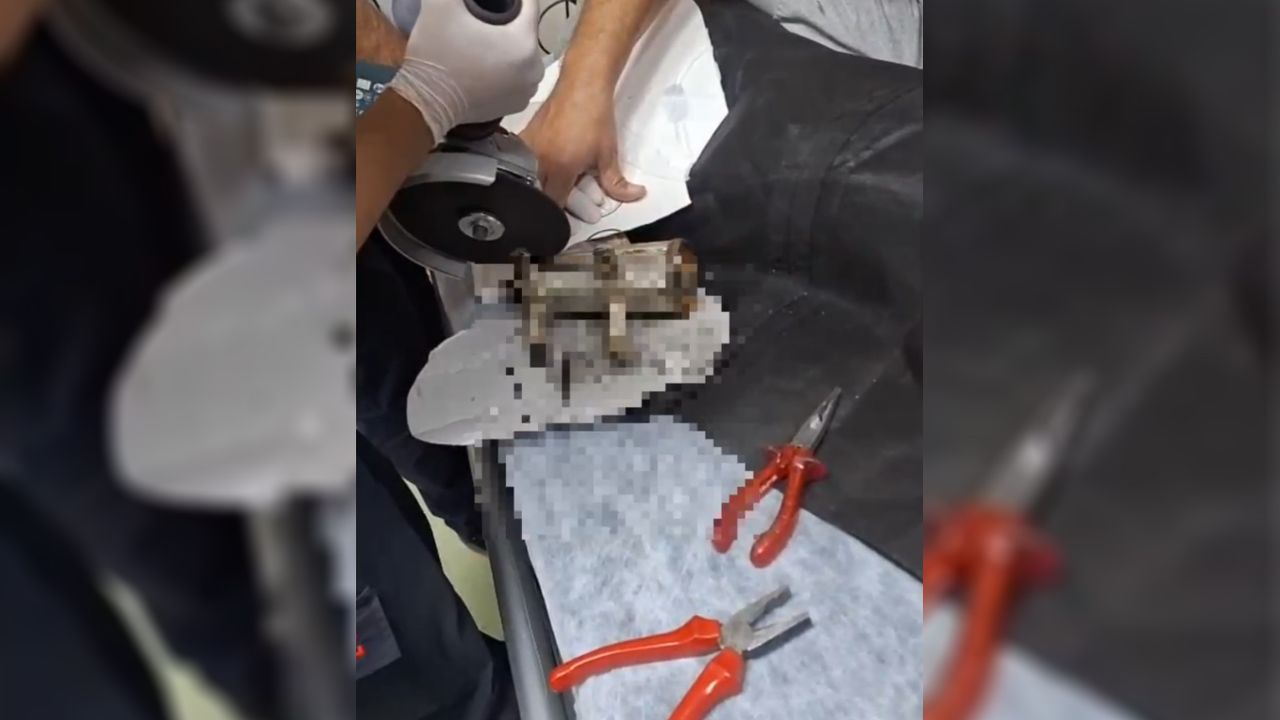 Süçük Sara’nın eli kıyma makinesinden kurtarıldı