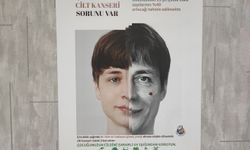 Cilt kanserinde erken tanı hayati önem taşıyor