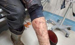 Veteriner hekim aşılama sırasında köpek saldırısına uğradı