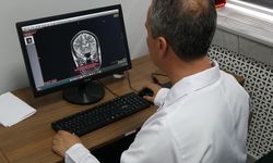 Türkiye’de inme ve felçten dolayı her yıl 45 bin insan ölüyor