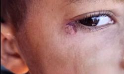 Öğrencinin yüzünde sigara söndüren temizlikçi tutuklandı