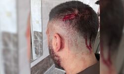 Öğretmene okulda demir sopalı saldırı