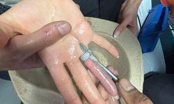 Parmağına sıkışan yüzük itfaiye ve doktorların müdahalesiyle çıkarıldı