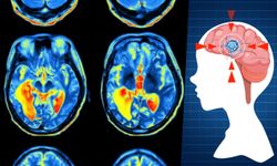 Bilim insanları beynin beş yaşam evresini belirledi: Kritik dönüm noktaları 9, 32, 66 ve 83 yaşında