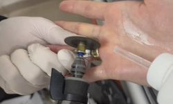 Batman’da Yüzüğü Parmağında Sıkışan Kadına İtfaiye Müdahale etti