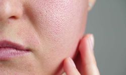 Delikli Örgü Gözenek Nedir?