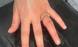 İtfaiye Parmakta Sıkışan Yüzüğü Çıkardı