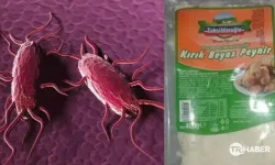 Tahsildaroğlu Sessizliğini Bozdu: Ölümcül Bakteri Sonrası Açıklama