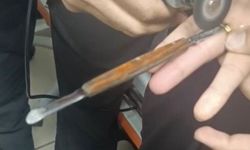 Batman'da parmağa sıkışan yüzük itfaiye ekiplerince kesildi