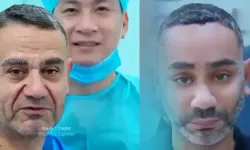 Vietnam'da Gençleşme Ameliyatı Olan Kişi Kimdir, Adı Ne, Ne Kadara Ameliyat Oldu, Gerçek mi? Dr. Kim?
