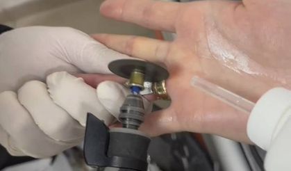 Batman’da Yüzüğü Parmağında Sıkışan Kadına İtfaiye Müdahale etti