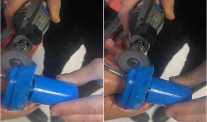 Parmağına sıkışan plastik parça itfaiye ekiplerince çıkarıldı