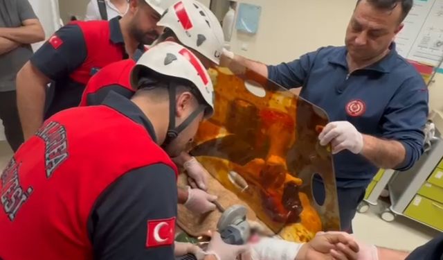 İşçinin koluna demir şiş saplandı