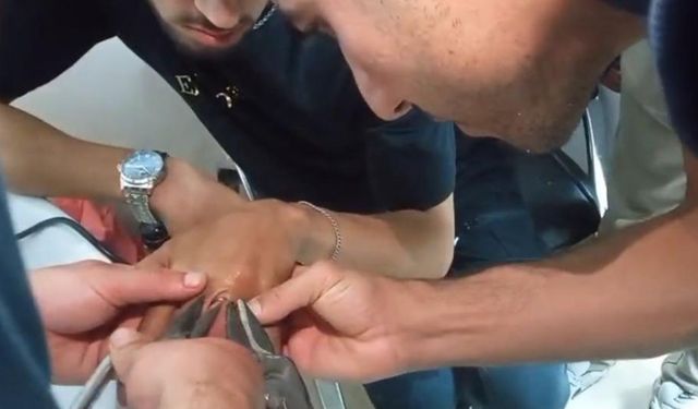Parmağına sıkışan yüzük itfaiye ekiplerince çıkarıldı