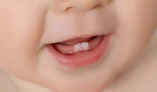 Diş sağlığı için erken yaşta önlem alınmalı