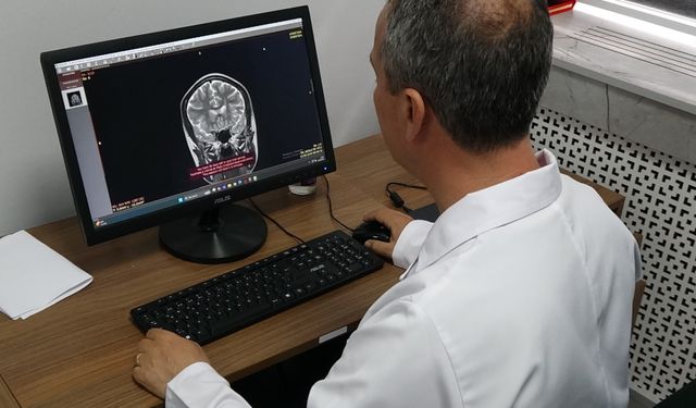 Türkiye’de inme ve felçten dolayı her yıl 45 bin insan ölüyor