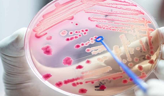 Sepsis her yıl 30 milyondan fazla insanı etkiliyor