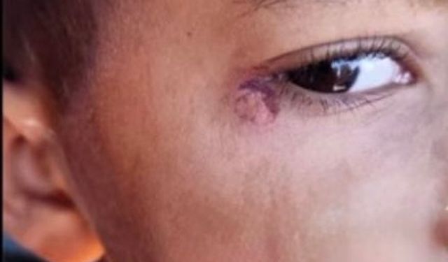 Öğrencinin yüzünde sigara söndüren temizlikçi tutuklandı