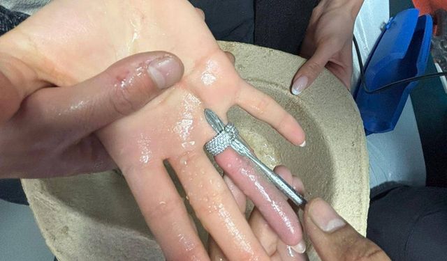 Parmağına sıkışan yüzük itfaiye ve doktorların müdahalesiyle çıkarıldı