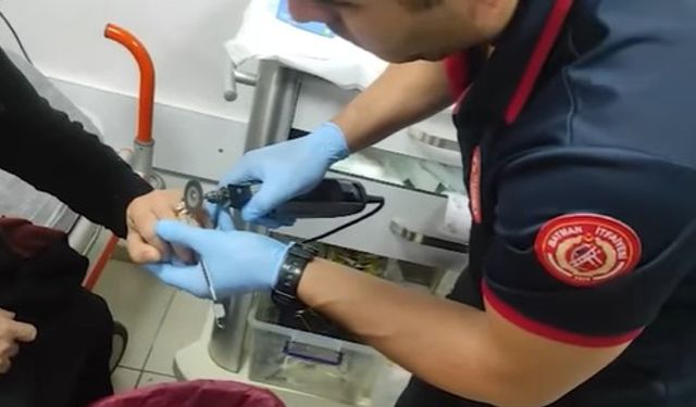 Batman itfaiyesi Parmağa sıkışan yüzüğü çıkardı