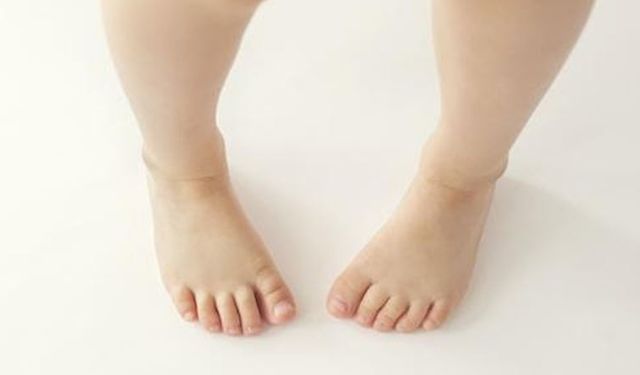 Çocuklarda içe basmaya karşı etkili önlemler!