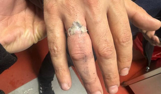 Parmağına Sıkışan Yüzük İçin 112’yi Aradı