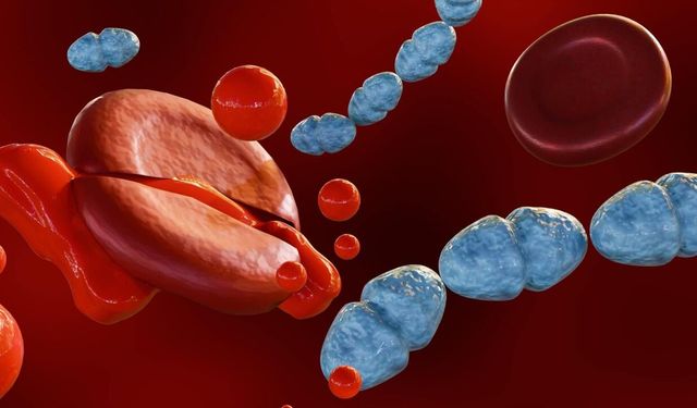 Sepsis ne demek, kan zehirlenmesi nasıl olur?