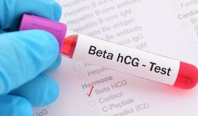 Beta HCG Ne Demek?
