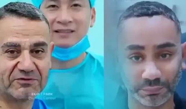Vietnam'da Gençleşme Ameliyatı Olan Kişi Kimdir, Adı Ne, Ne Kadara Ameliyat Oldu, Gerçek mi? Dr. Kim?