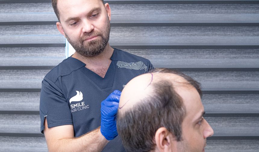 'Hormonal saç dökülmesinde, ekim doğal çözümdür'