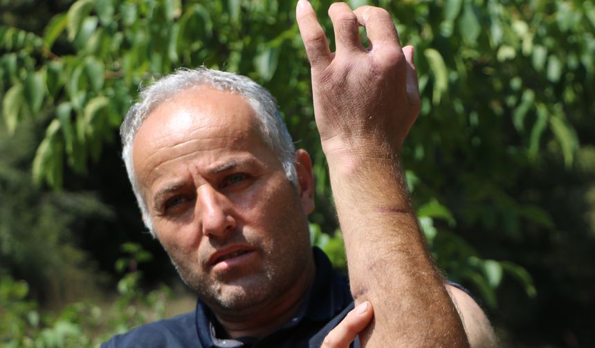 Babası gibi ayı saldırısına uğradı; parmağı koptu