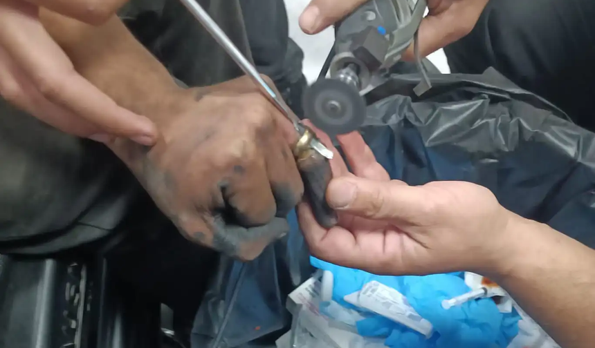 Batman'da parmakta sıkışan yüzük operasyonuyla çıkarıldı
