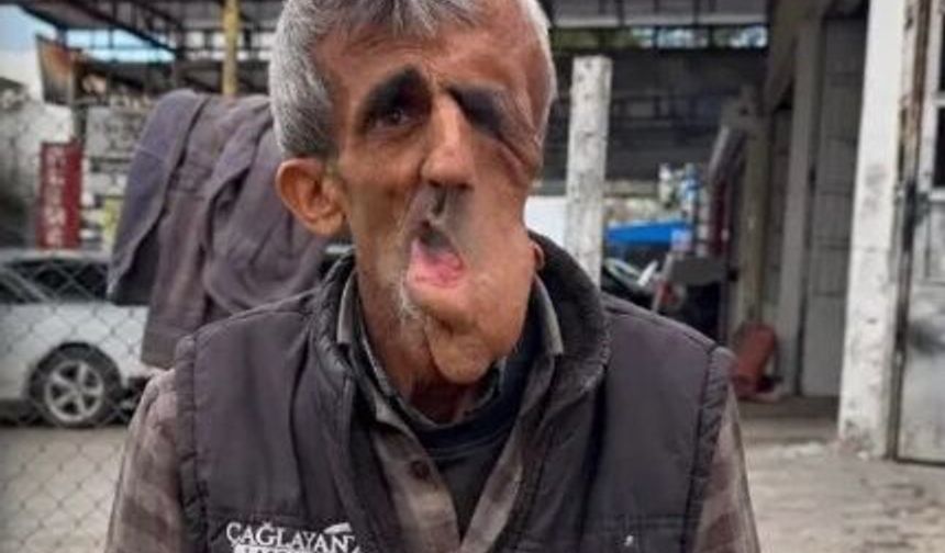 Batman Sanayisini Yasa Boğan Vefat: Zeki Çelik Hayatını Kaybetti