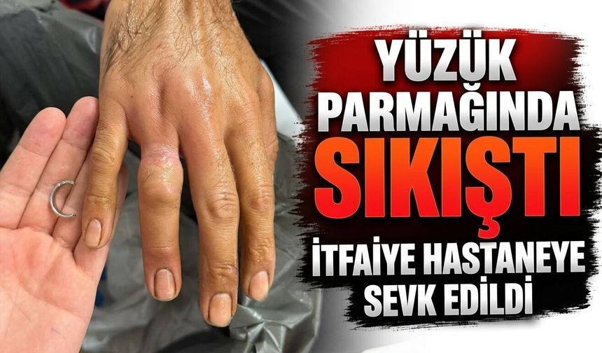 Yüzük Parmağında Sıkıştı, İtfaiye Hastaneye Sevk Edildi