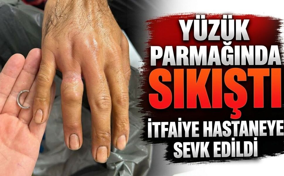 Yüzük Parmağında Sıkıştı, İtfaiye Hastaneye Sevk Edildi